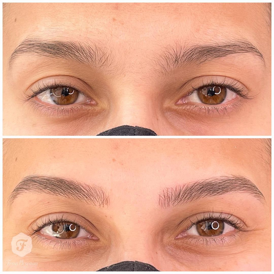 A Real Diferença do Antes e Depois da Micro nas Sobrancelhas - Fran ...