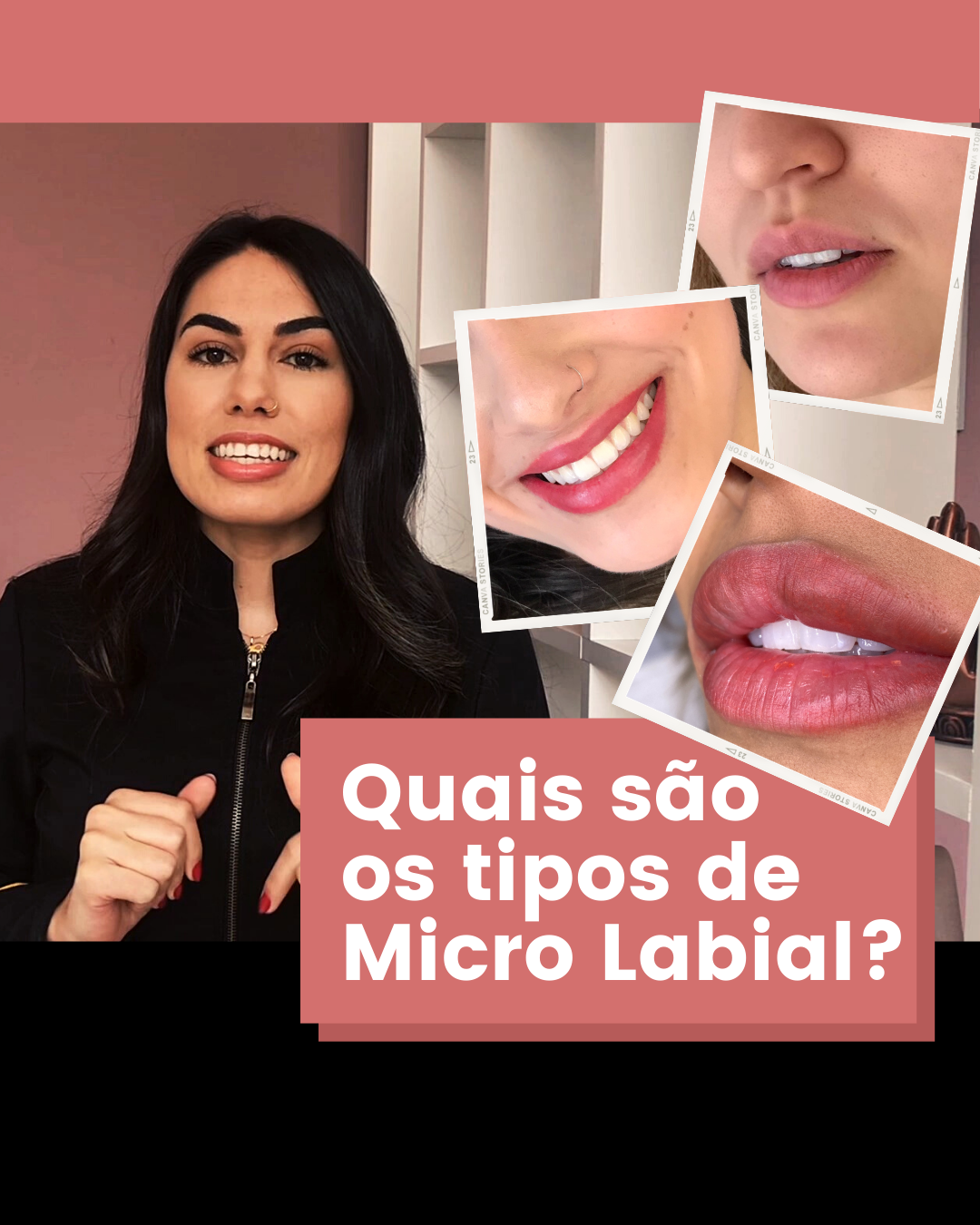 labial quais tipos nov20 thumb