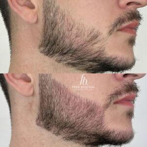 preenchimento de barba fran boscaini curso online micropigmentacao 2 min