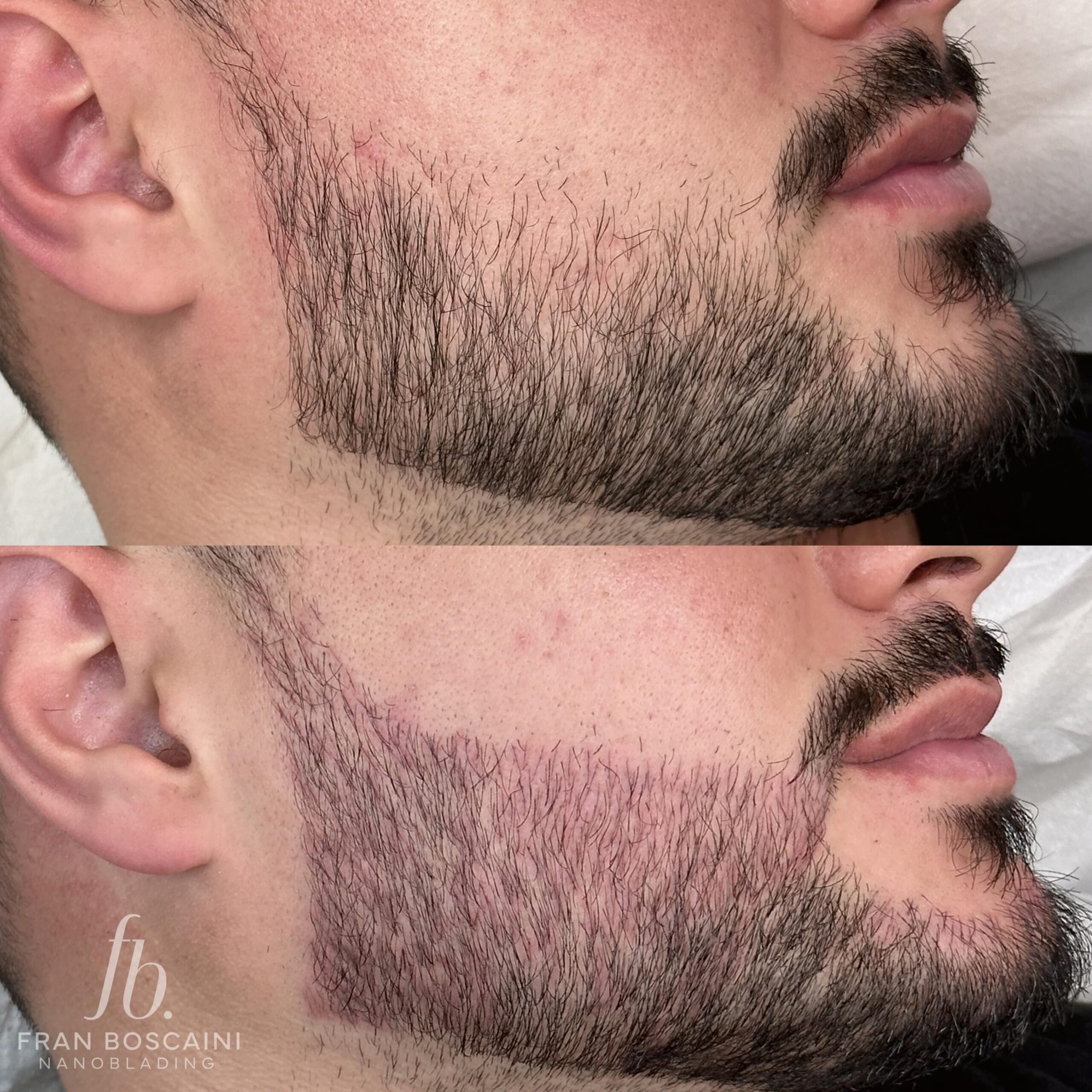 preenchimento de barba fran boscaini curso online micropigmentacao 3 min scaled