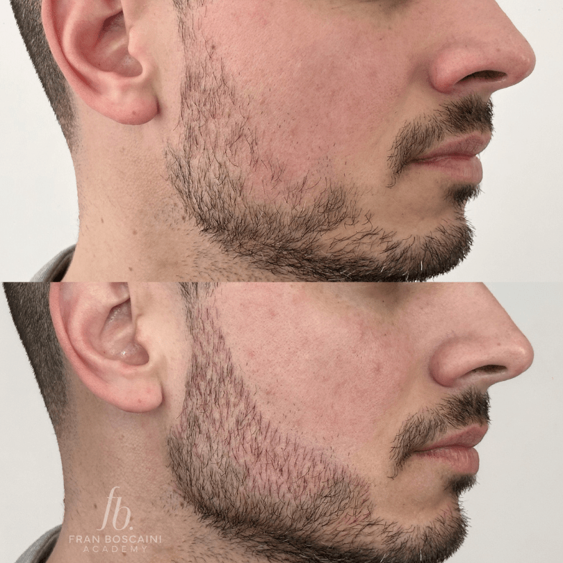 curso online nanoblading de barba fran boscaini 1 min