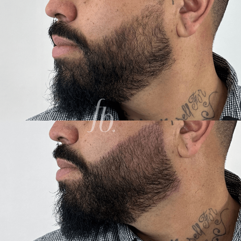 curso online nanoblading de barba fran boscaini 3 min