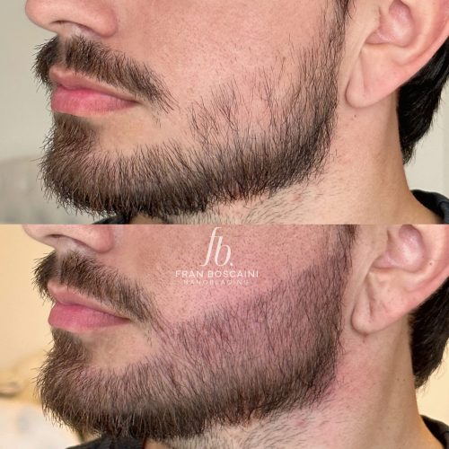 micro-barba-homem-porto-alegre-nanoblading-fran-boscaini (2)