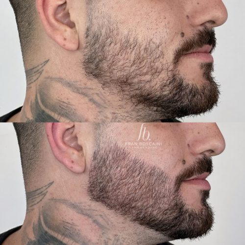micro-barba-homem-porto-alegre-nanoblading-fran-boscaini (3)