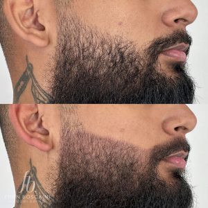 preenchimento de barba fran boscaini curso online micropigmentacao 4 min scaled